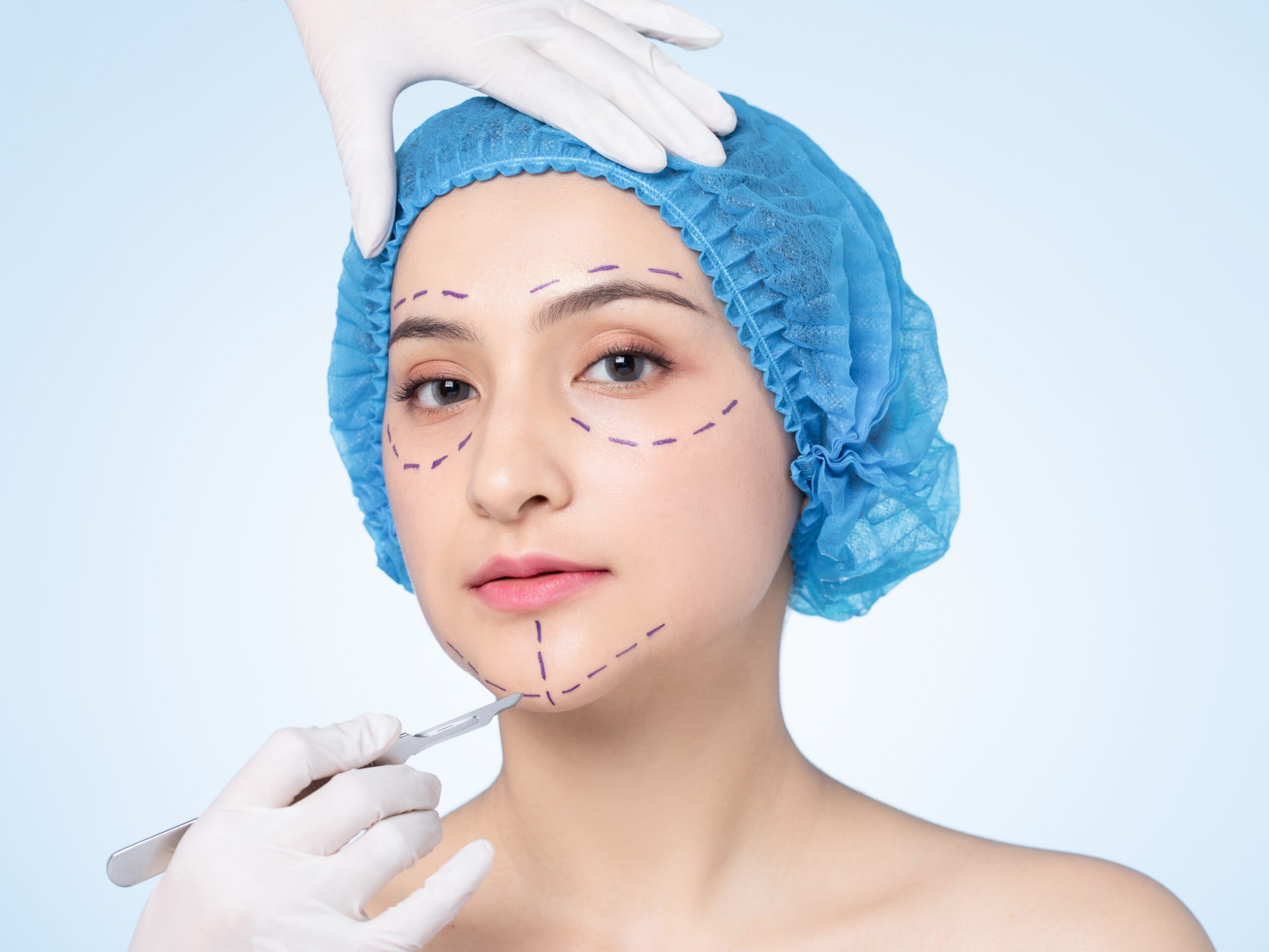 ศัลยกรรมความงามขนาดเล็ก หัตถการก่อนวันแต่ง เตรียมตัวก่อนแต่งงาน บ่าวสาว ดูแลผิวก่อนแต่งงาน หน้าใสก่อนแต่งงาน ทรีทเมนต์ผิวหน้าเจ้าสาว ดูแลรูปร่างก่อนแต่งงาน ปรับรูปหน้าเจ้าสาว สกินบูสเตอร์ก่อนแต่งงาน ทรีทเมนต์ผิวออร่า ช็กลิสต์ความสวยก่อนแต่งงาน